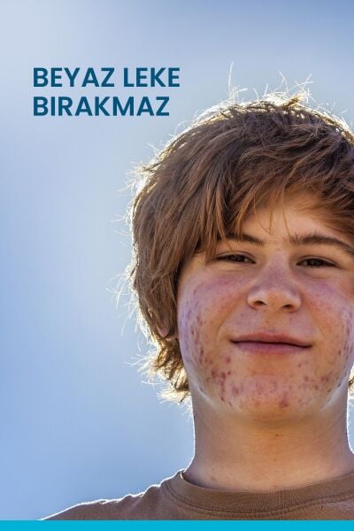 Keracnyl UV Fluid SPF 50+ Yağlı ve Akneye Eğilimli Ciltler için Matlaştırıcı Güneş Kremi 50 ml