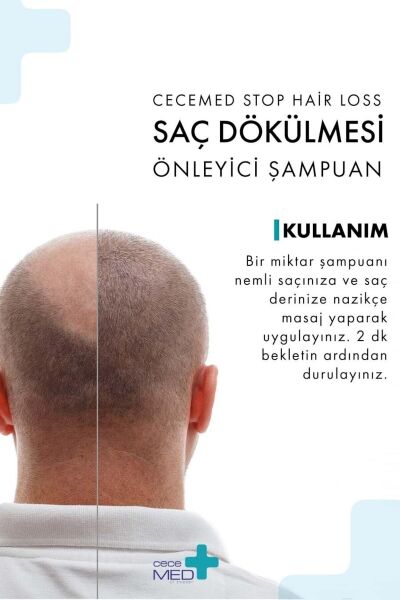 CECEMED Saç Dökülmesi Önleyici Şampuan 300 Ml